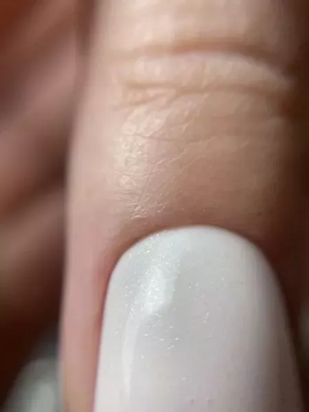 palec-z-paznokciem-w-odcieniu-bieli